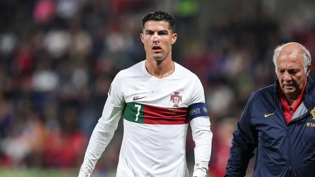 Ronaldo bị thủ môn đối phương đấm gãy mũi - Ảnh 3.