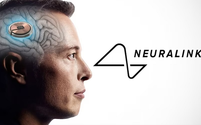 Công ty Neuralink của Elon Musk được phép thử nghiệm cấy chip vào não người